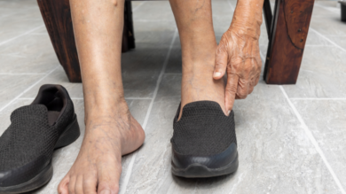 Leaking Lymph? Lymphorrhea Explained.