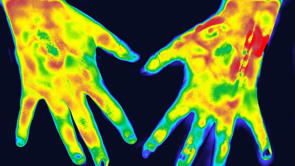 Infrared Thermography